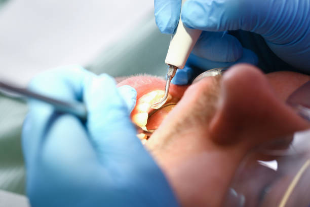 Best Affordable Emergency Dental Care  in Amherst, TX