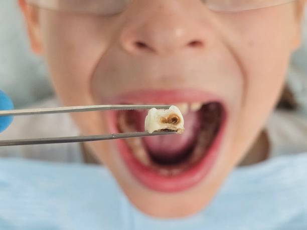 Best Emergency Dentist Near Me  in Amherst, TX