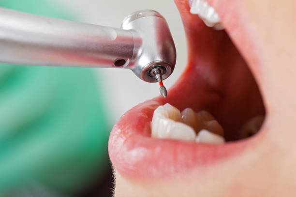 Best Broken Tooth Emergency  in Amherst, TX
